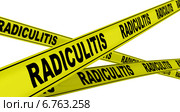 Радикулит (radiculitis). Желтая оградительная лента. Стоковая иллюстрация, иллюстратор WalDeMarus / Фотобанк Лори