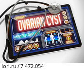 Киста яичников. Надпись Ovarian Cyst на экране планшета и стетоскоп. Стоковая иллюстрация, иллюстратор Илья Урядников / Фотобанк Лори
