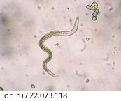 Личинка Toxocara canis второй стадии развития. Стоковое фото, фотограф Руднева Ольга / Фотобанк Лори