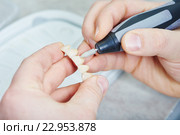 dental prosthesis work. Стоковое фото, фотограф Дмитрий Калиновский / Фотобанк Лори