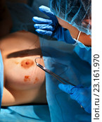 Surgeon operates women's breasts . Стоковое фото, фотограф Gennadiy Poznyakov / Фотобанк Лори