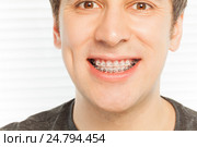 Happy face of young man with dental braces. Стоковое фото, фотограф Сергей Новиков / Фотобанк Лори