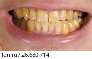 Yellow teeth of a man. Стоковое видео, видеограф Илья Шаматура / Фотобанк Лори