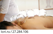 Alternative Asian Tibetan medicine, treatment using glass jars, jars placement. Стоковое видео, видеограф Константин Шишкин / Фотобанк Лори