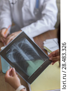 Confident practitioner consulting woman in hospital. Explaining results of chest x-ray scan. Стоковое фото, агентство Ingram Publishing / Фотобанк Лори