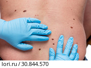 Dermatologist looking ar birthmark on patient. Стоковое фото, фотограф Константин Лабунский / Фотобанк Лори