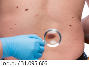 Dermatologist examining the skin on the back of a patient. Стоковое фото, фотограф Константин Лабунский / Фотобанк Лори