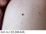 Иксодовый клещ (Ixodes ricinus) ползёт по коже человека. Стоковое фото, фотограф Светлана Попова / Фотобанк Лори