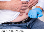 Patient suffering from diabetes visiting doctor. Стоковое фото, фотограф Elnur / Фотобанк Лори