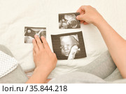 Pregnant woman holding 4D ultrasound image. Expectation of a child. Стоковое фото, фотограф Irina Kuchugurina/Gaudy / Фотобанк Лори