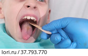 Boy opens her mouth wide and pulls out long tongue. child shows his teeth soft palate and mouth to dentist. mouth is wide open, tongue is stuck out as far as possible, with clear view of tongue. Стоковое видео, видеограф Ирина Ткачук / Фотобанк Лори