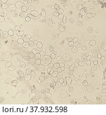 Transitional epithelium of a bladder. Стоковое фото, фотограф Вероника Веребрюсова / Фотобанк Лори