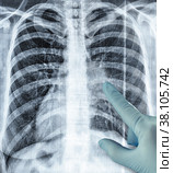 Pneumonia virus lung bones radiograph snapshot hand in glove. Стоковое фото, фотограф Camptoloma / Фотобанк Лори