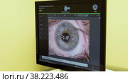 RUSSIA, VATUTINKI - OCT 13, 2022: Correction clinic eye surgery laser operation lens medicine lasik, from, ophthalmologist vision. Стоковое видео, видеограф ilya Lyubchenko / Фотобанк Лори