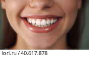 Woman teeth before and after whitening. Over white background. Generative AI. Стоковое AI-изображение, AI-художник Ирина Ручушкина / Фотобанк Лори