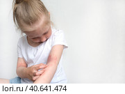 Ребенок чешет атопичную кожу. Дерматит, диатез, аллергия на теле ребенка. Стоковое фото, фотограф Терехова Марина / Фотобанк Лори