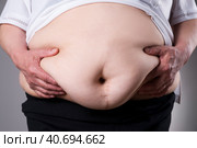Obesity woman body, fat female belly with a scar from abdominal surgery close up. Стоковое фото, фотограф Станислав Тарко / Фотобанк Лори