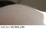 Needle injecting into the muscle. Nurse doing a trigger point injection in patient back. Close up doctor makes an shot therapy. Alternative pain treatment. Covid-19, pox, MPOX, flu virus vaccine. Стоковое видео, видеограф Марина Демидюк / Фотобанк Лори