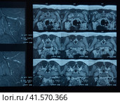 MRI sacroiliac articulation. Study of ankylosing spondyloarthritis patient. Стоковое фото, фотограф Леонид Еремейчук / Фотобанк Лори