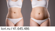 Woman's body before and after weight loss on gray background. Стоковое фото, фотограф Станислав Тарко / Фотобанк Лори
