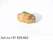 Stone of gallbladder. The result of gallstones. A calculus of heterogeneous composition. Стоковое фото, фотограф Леонид Еремейчук / Фотобанк Лори