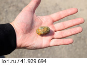 Gallstone in hand, Gall bladder stone. result of gallstones. Calculus of heterogeneous composition. Стоковое фото, фотограф Леонид Еремейчук / Фотобанк Лори