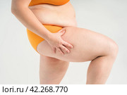 Overweight woman, fat hips, thighs and legs, obesity female body with cellulite and varicose veins on studio background. Стоковое фото, фотограф Станислав Тарко / Фотобанк Лори