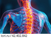 Hernia of the cervical spine, neck pain, spondylosis of the intervertebral disc, health problems concept, AI Generated. Стоковое AI-изображение, AI-художник Станислав Тарко / Фотобанк Лори