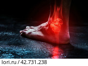 Barefoot walking on dark wooden floor. Bare foots with red effect of pain. Painful gout inflammation. Tingling and burning sensation in foot. Sensory neuropathy problems. Healthcare and podiatry. Legs. Стоковое AI-изображение, AI-художник Марина Демидюк / Фотобанк Лори