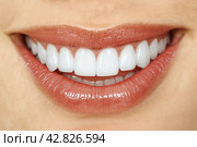 Dental services.Teeth whitening.Implants.Crowns for teeth.Veneers for teeth. A beautiful smile of a girl after dental treatment. Стоковое AI-изображение, AI-художник Александр Поташев / Фотобанк Лори