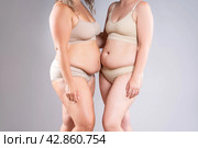 Two overweight women with cellulitis, fat flabby bellies, legs, hands, hips and buttocks on gray background, obese female body, liposuction and plastic surgery concept. Стоковое фото, фотограф Станислав Тарко / Фотобанк Лори