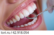 Close up of female mouth with dental mirror. Dentistry concept. Стоковое AI-изображение, AI-художник Katsiaryna Repich / Фотобанк Лори