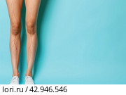 Patient with sign of varicose veins symptoms on a legs. Blue background. Leg pain. Phlebology. Venous pathologies of the lower extremities. Human vessel, arteries. Capillaries. Blood system. Banner. Стоковое AI-изображение, AI-художник Марина Демидюк / Фотобанк Лори