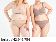 Two overweight women with cellulitis, fat flabby bellies, legs, hands, hips and buttocks on gray background, obese female body, liposuction and plastic surgery concept. Стоковое фото, фотограф Станислав Тарко / Фотобанк Лори