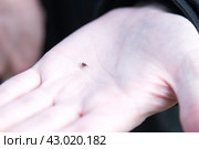 Клещ (лат. Acarina) на ладони. Стоковое фото, фотограф Елена Коромыслова / Фотобанк Лори