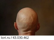 Smooth Baldness head problem. Generate ai. Стоковое AI-изображение, AI-художник Иван Рябоконь / Фотобанк Лори