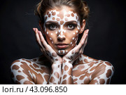 Leukoderma. Vitiligo. Violation of skin pigmentation. Large white spots all over the body and face. Portrait of a beautiful girl with a skin disease. Стоковое AI-изображение, AI-художник Photojuli / Фотобанк Лори