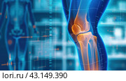 High-tech computer model of a leg with an inflamed knee joint. X-ray of the knee joint. Стоковое AI-изображение, AI-художник Александр Довянский / Фотобанк Лори
