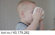 Little boy with redness on face drinks from mug expression reflecting discomfort. Redness spots on face boy enjoy beverage Noticeable redness on his face reveals severity of illness. Стоковое видео, видеограф Olesia Kondrateva / Фотобанк Лори