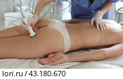 Cosmetologist utilizing high-frequency ultrasound attachment for hardware procedure on buttocks of female client in cosmetology office. Non-surgical body sculpting. Стоковое видео, видеограф Яков Филимонов / Фотобанк Лори