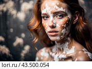 Leukoderma. Vitiligo. Violation of skin pigmentation. Large white spots all over the body and face. Portrait of a beautiful girl with a skin disease. Стоковое AI-изображение, AI-художник Photojuli / Фотобанк Лори