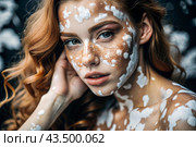 Leukoderma. Vitiligo. Violation of skin pigmentation. Large white spots all over the body and face. Portrait of a beautiful girl with a skin disease. Стоковое AI-изображение, AI-художник Photojuli / Фотобанк Лори