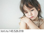 Грустная девочка с атопическим дерматитом и расчесами на руках, псориаз. Стоковое AI-изображение, AI-художник Терехова Марина / Фотобанк Лори