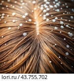 Dandruff problem. A head with itchy head. Стоковое AI-изображение, AI-художник Виктор Застольский / Фотобанк Лори
