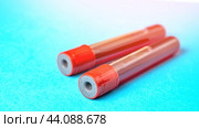 Blood test for the monkey pox virus. A laboratory assistant holds a test tube with blood in his hands, a suspicion of the monkey pox virus. The concept of the smallpox pandemic and viral infection. Стоковая иллюстрация, иллюстратор Скрипачев Антон / Фотобанк Лори