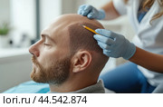 Doctor performing scalp micro pigmentation on male patient. Стоковое AI-изображение, AI-художник Юрий Поздников / Фотобанк Лори