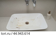 Dirty white bathroom sink before and after cleaning, time lapse. The unclean bathroom washbasin had visible stains around the drain, but after scrubbing, the whole area looks laundered and fresh. Стоковое видео, видеограф Андрей Журавлев / Фотобанк Лори