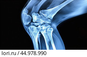 X-ray image of human knee showing bones and ligaments. Стоковое AI-изображение, AI-художник Юрий Поздников / Фотобанк Лори