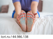 Joint diseases, hallux valgus, plantar fasciitis, woman's leg hurts, pain in the foot, female feet closeup. Стоковое фото, фотограф Станислав Тарко / Фотобанк Лори