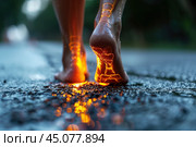 Legs burning in fire, heel spur, woman's leg hurts, pain in the foot, skin diseases, female feet with dry cracked skin close-up. Стоковое AI-изображение, AI-художник Станислав Тарко / Фотобанк Лори